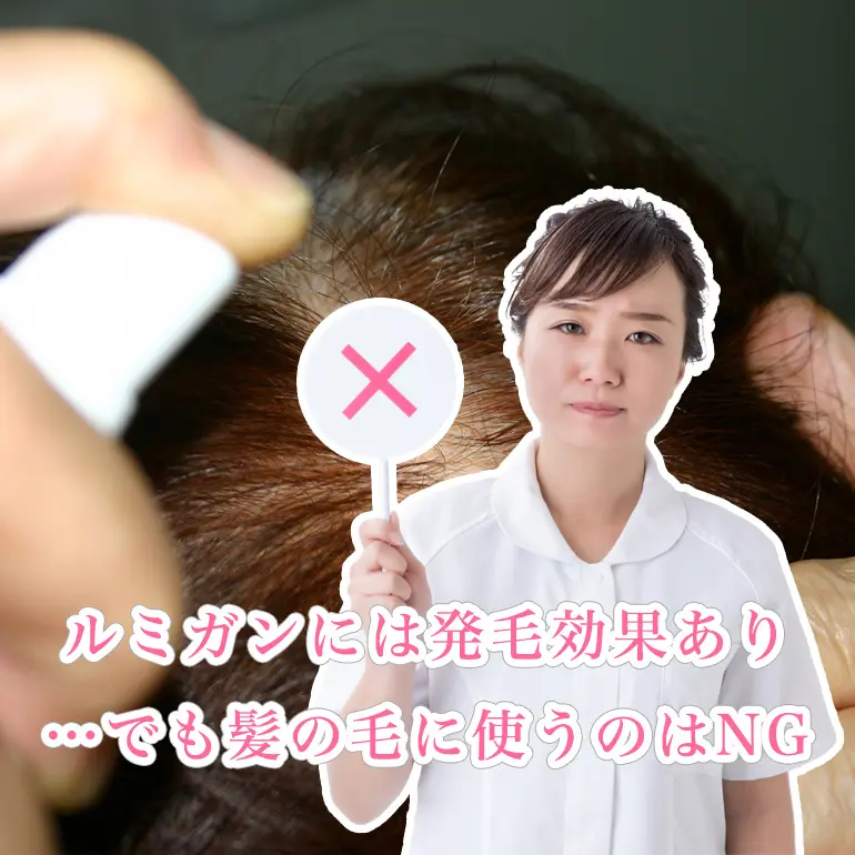 ルミガンには髪の毛の発毛効果あり でも絶対頭に使ってはいけない理由とは 個人輸入代行 通販ラククル