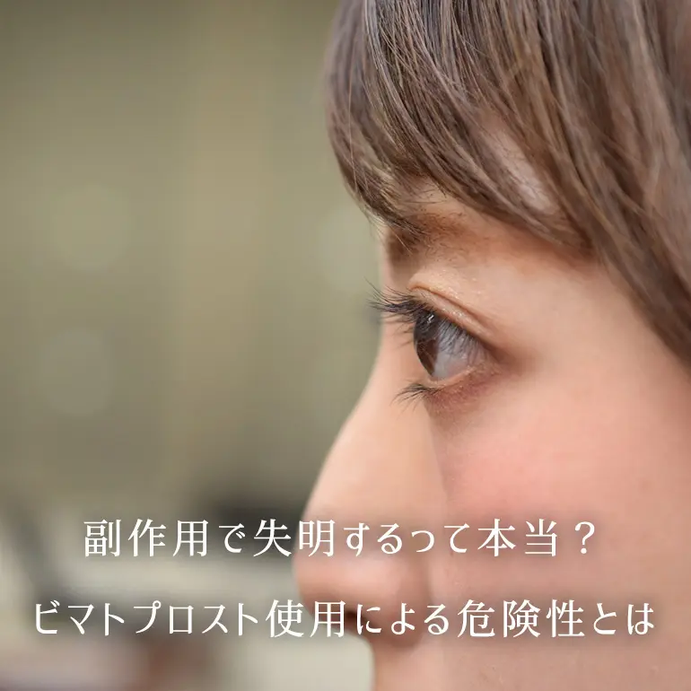 副作用で失明するって本当 ビマトプロスト使用による危険性を解説します 個人輸入代行 通販ラククル