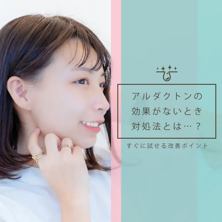 アルダクトン(スピロノラクトン)がニキビに効かない・治らない時に