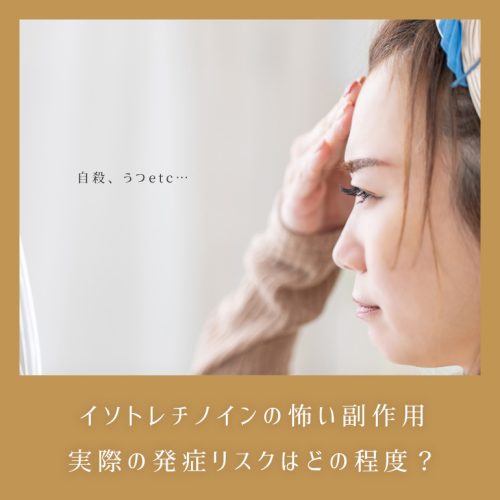 自殺、うつetc…イソトレチノインの怖い副作用、実際の危険性はどの程度?