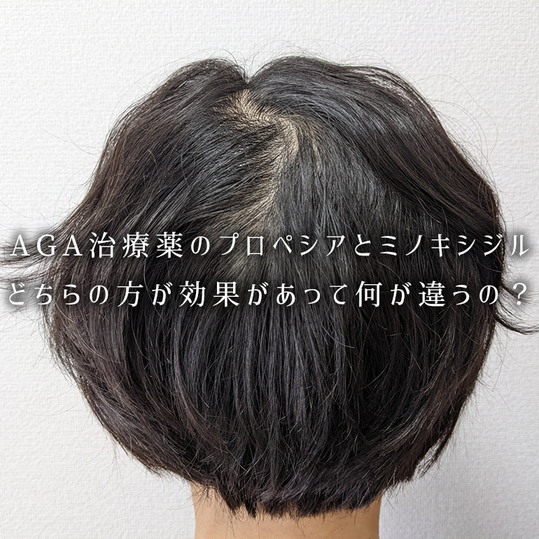 AGA治療薬のプロペシアとミノキシジル、どちらの方が効果があって何が違うの?
