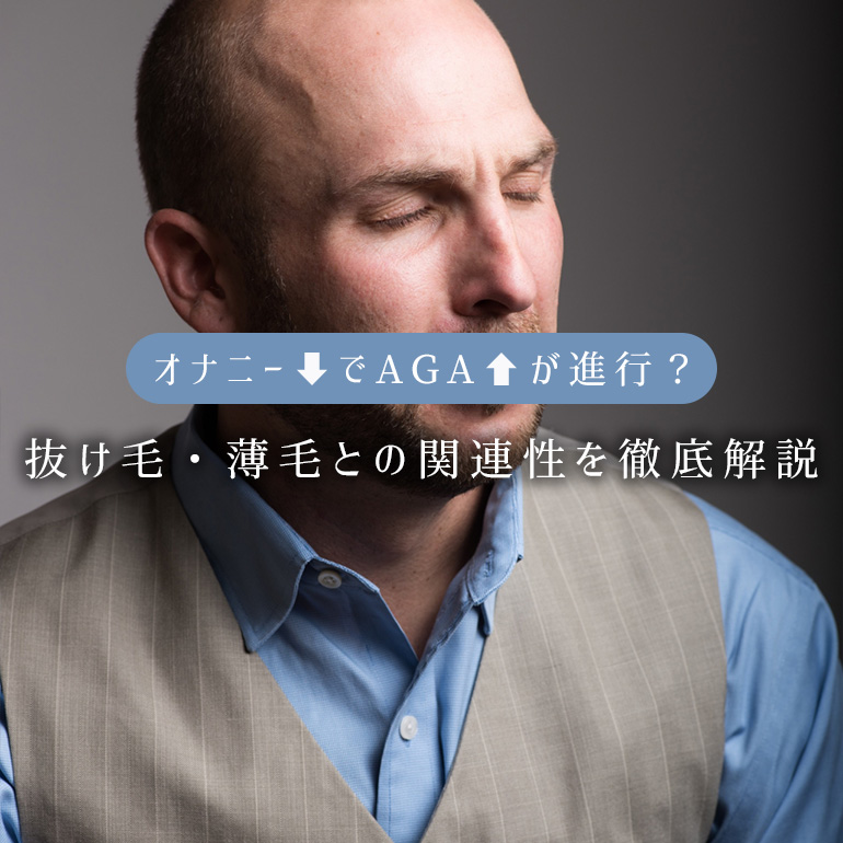 オナニーがハゲ(AGA)の原因になるって本当?抜け毛・薄毛との関連性を徹底解説