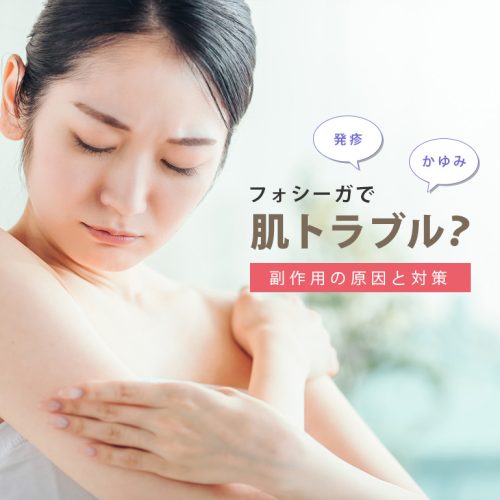 フォシーガの副作用で皮膚障害って本当?服用リスクから対処法まで解説