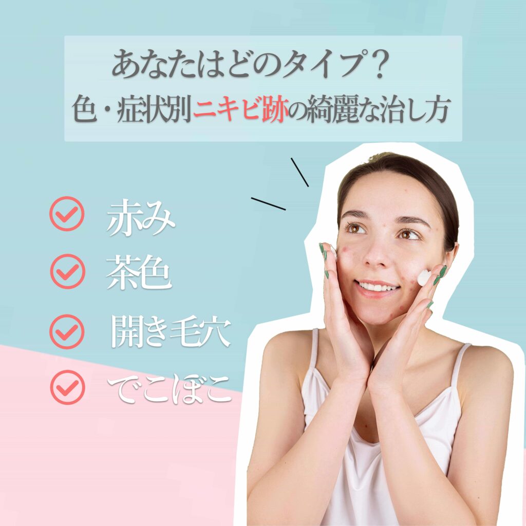 ニキビ跡の治療法