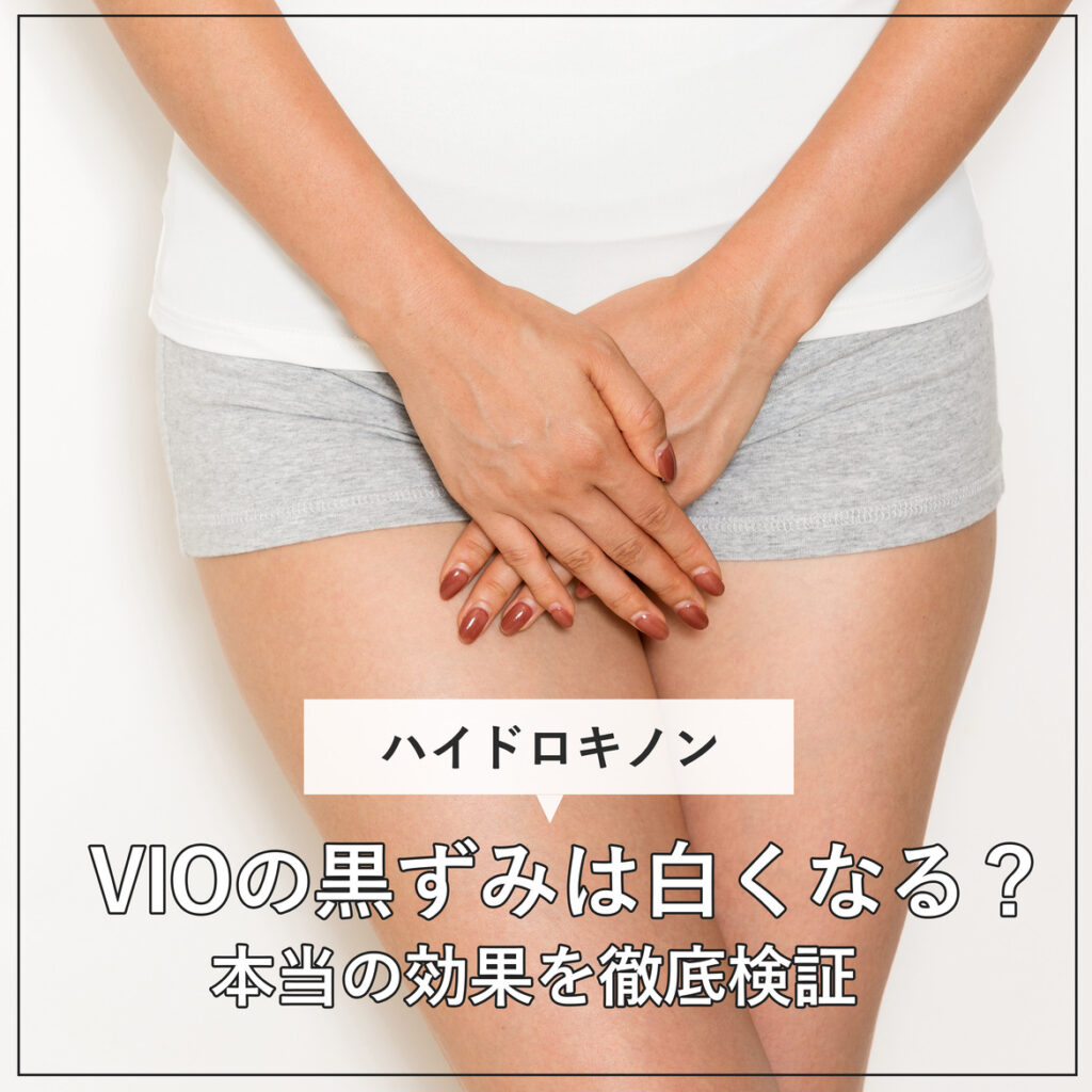 ハイドロキノンでVIOは白くなる？気になるデリケートゾーンの黒ずみへの効果を徹底解説！