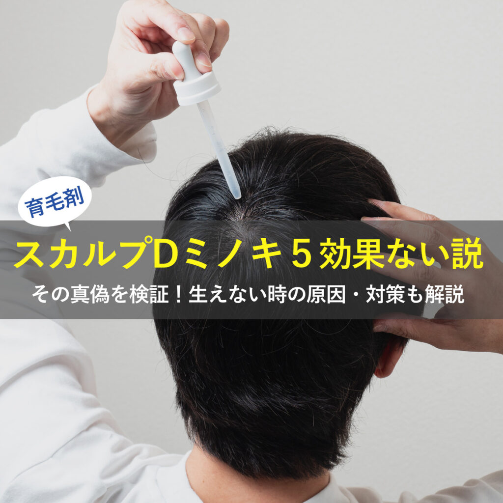 【スカルプDミノキ５(育毛剤)効果ない説】は本当？生えない原因と対策も徹底解説します！