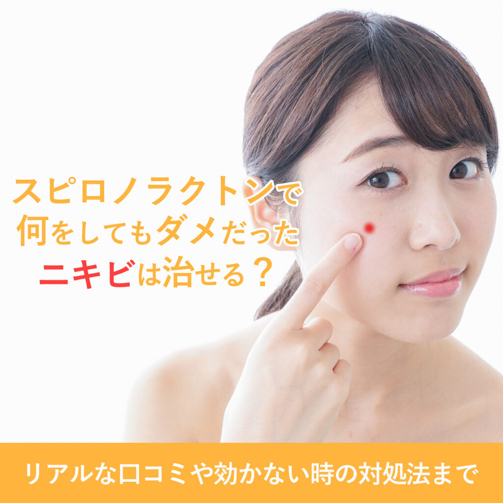 「ニキビ消滅」「逆に悪化した」スピロノラクトンのリアルな効果を口コミ調査！