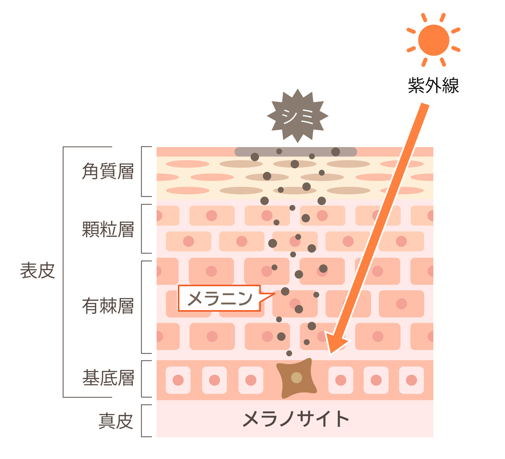 シミができるメカニズム